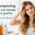 Femme se tenant le cuir chevelu avec démangeaisons avant de choisir un shampooing adapté